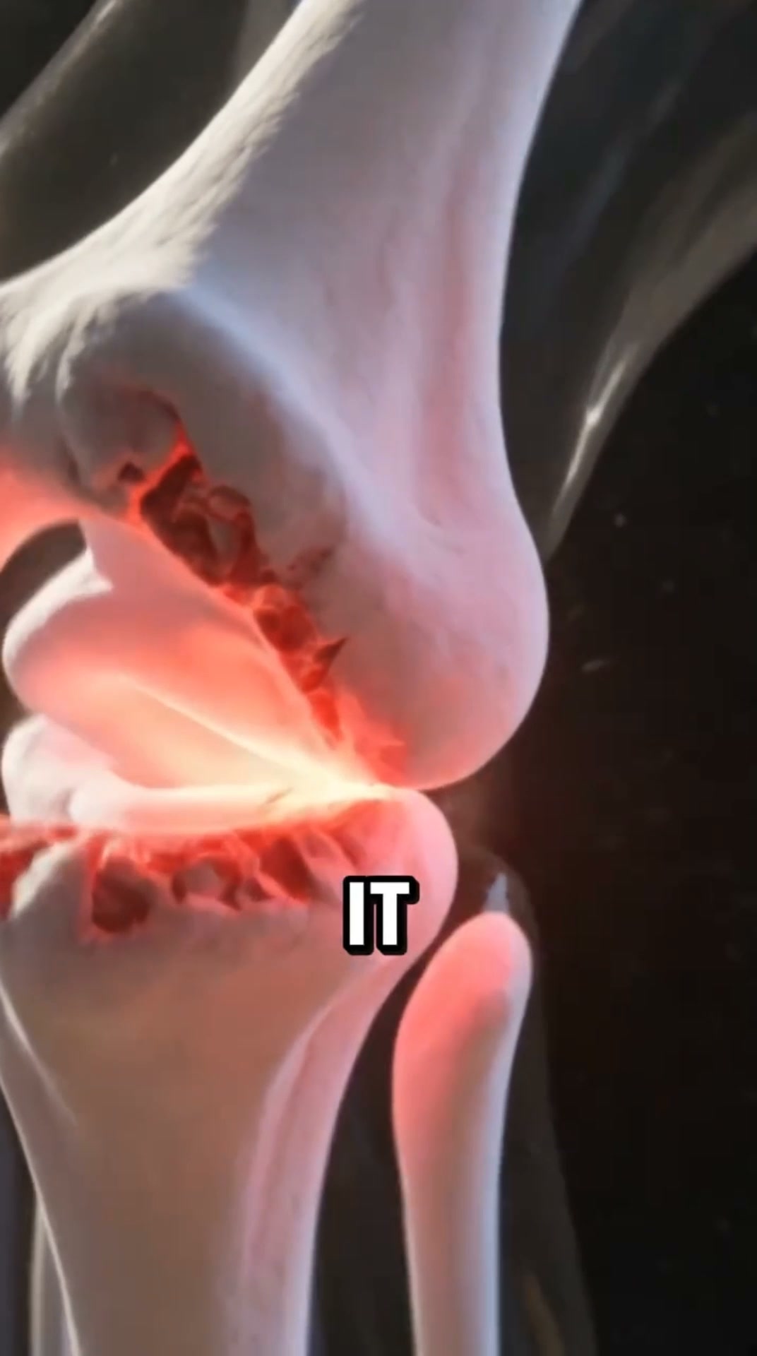 Joint lubrication in a capsule