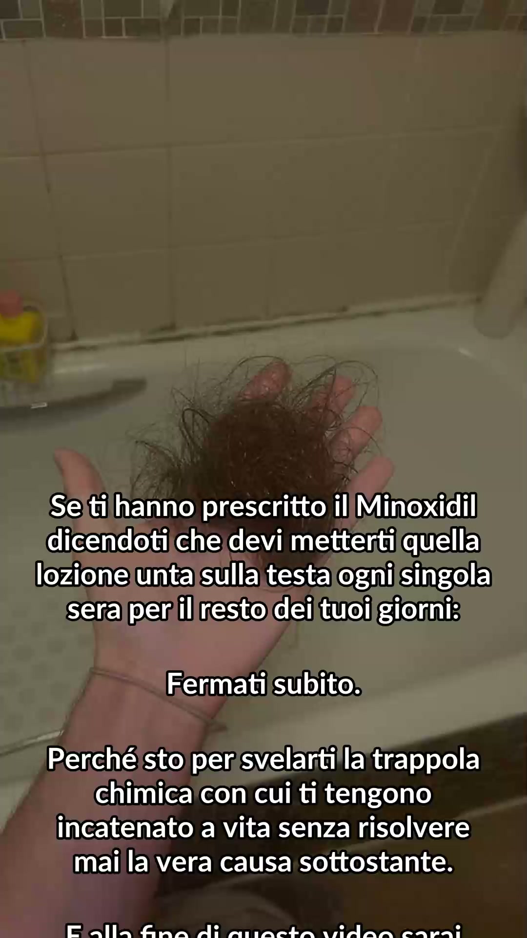 Guarda questo se i tuoi capelli stanno cadendo
