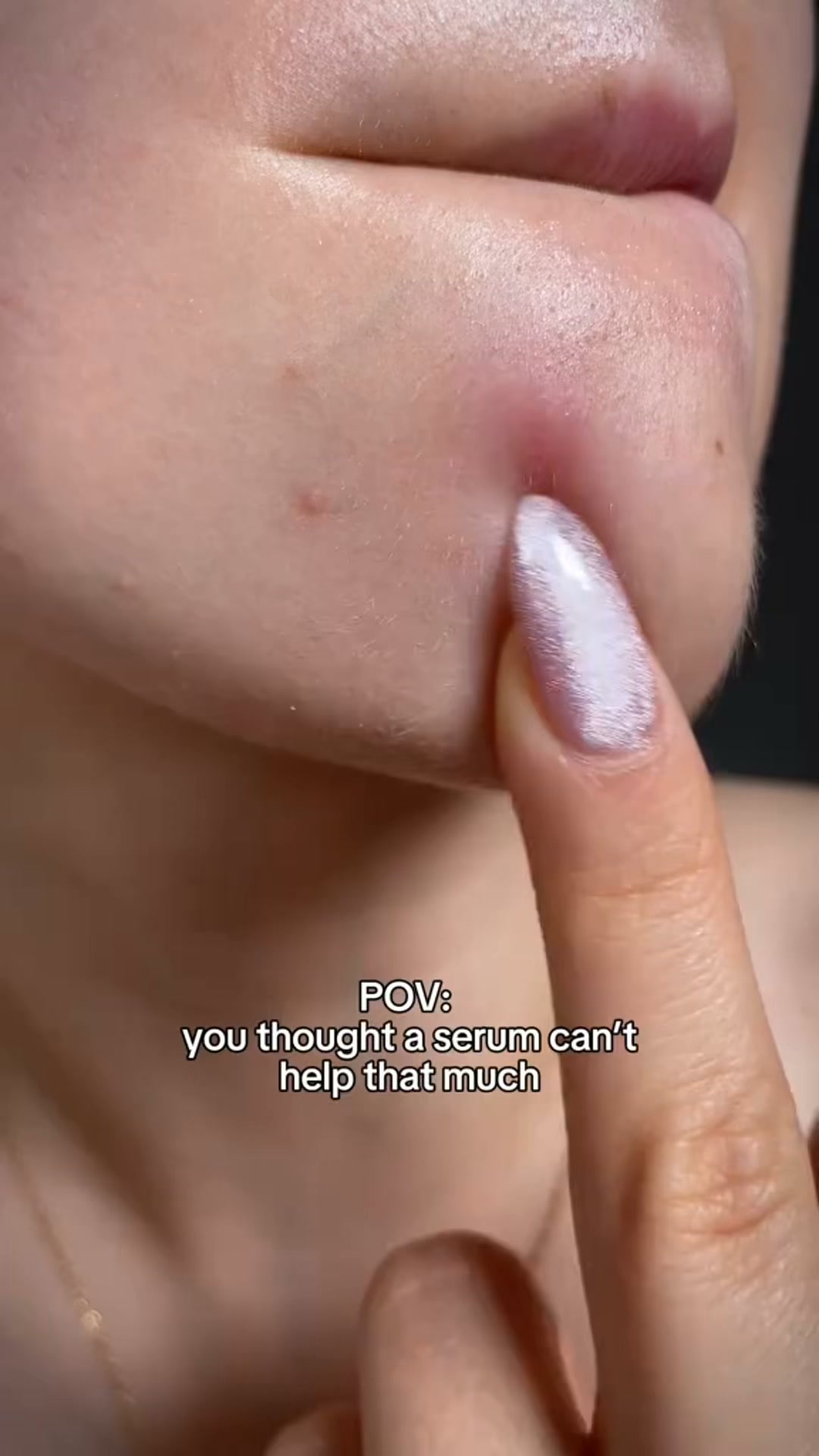 Calmer, Clearer-Looking Skin