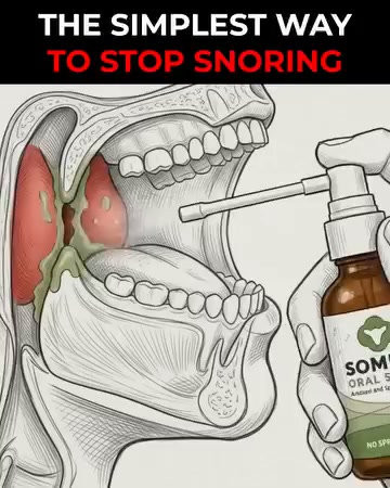 The smarter way to stop snoring!