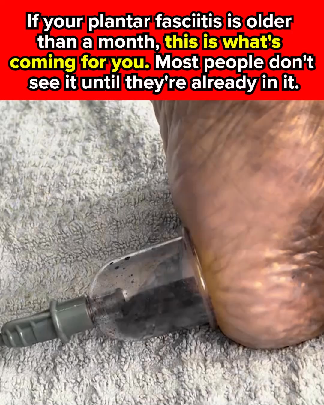 Plantar Fasciitis Doesn't Just Hurt. It Rewrites Your Whole Life Around Foot Pain.