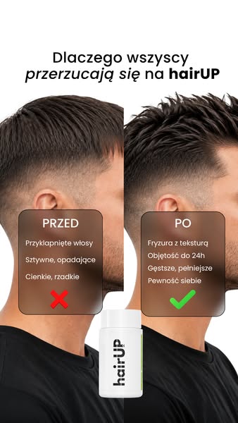 PRZED vs PO zobacz różnicę z hairUP