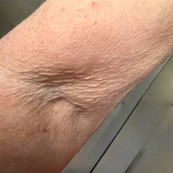 What The Jab Gives, Then Quietly Takes