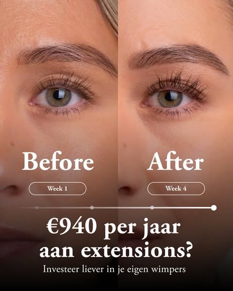 Zichtbaar langere wimpers in 28 dagen