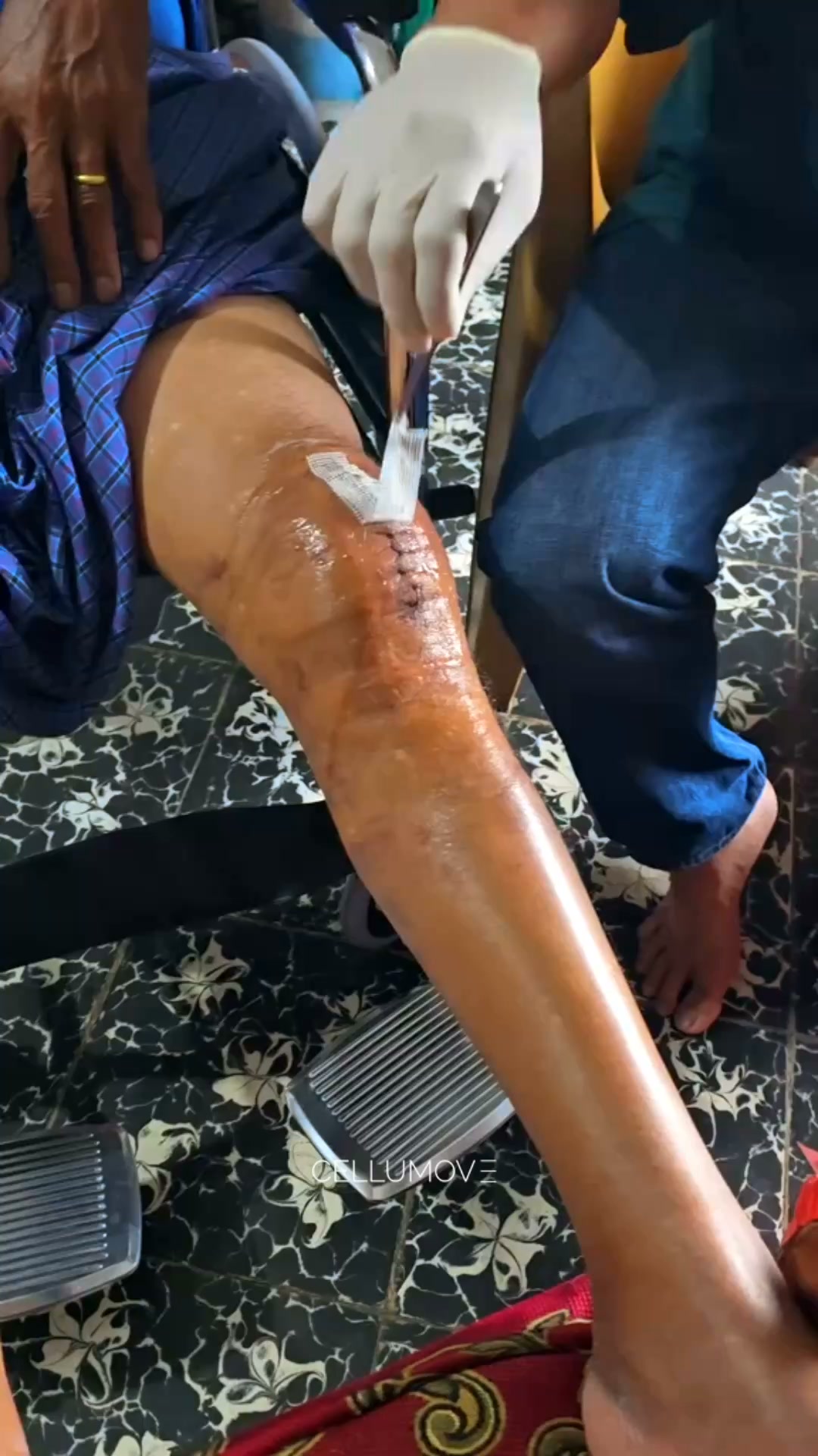 Give Your Knees the Support They Deserve