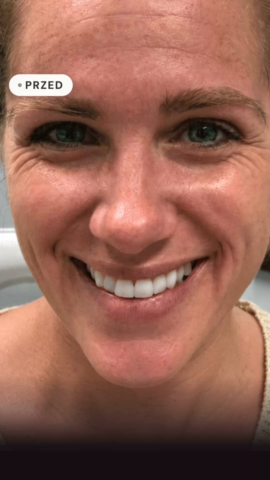 Obudź się rano z gładką cerą