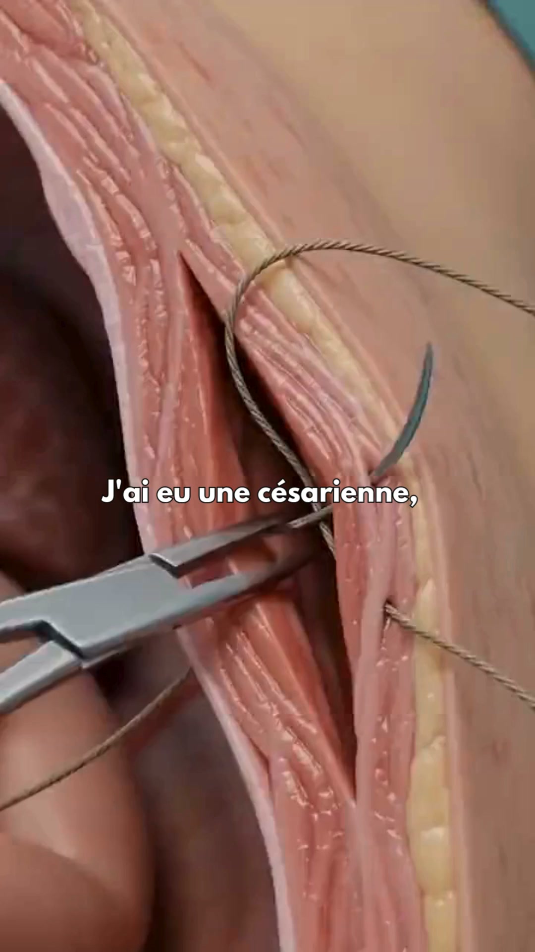 Enfin un ventre post-grossesse plus ferme