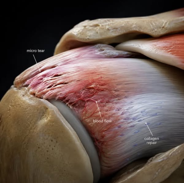 Shoulder still hurts after physio? Here's what you're missing.