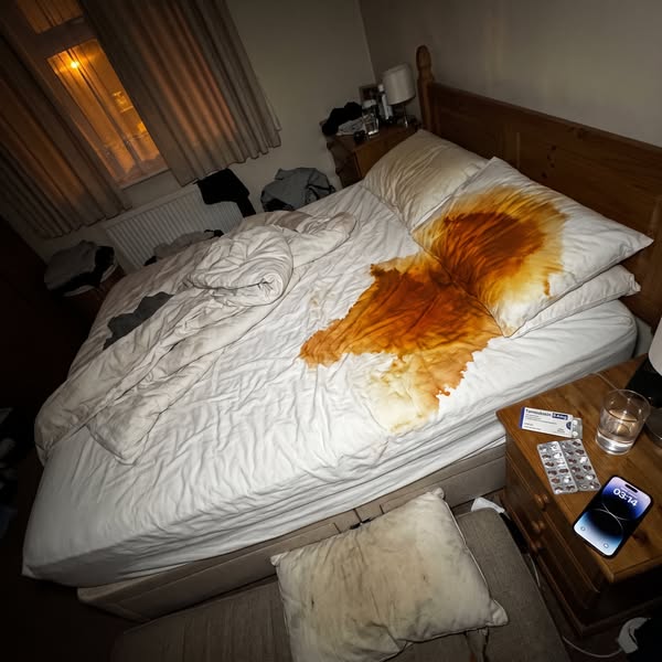 Sleep Apnoea - Not Prostate