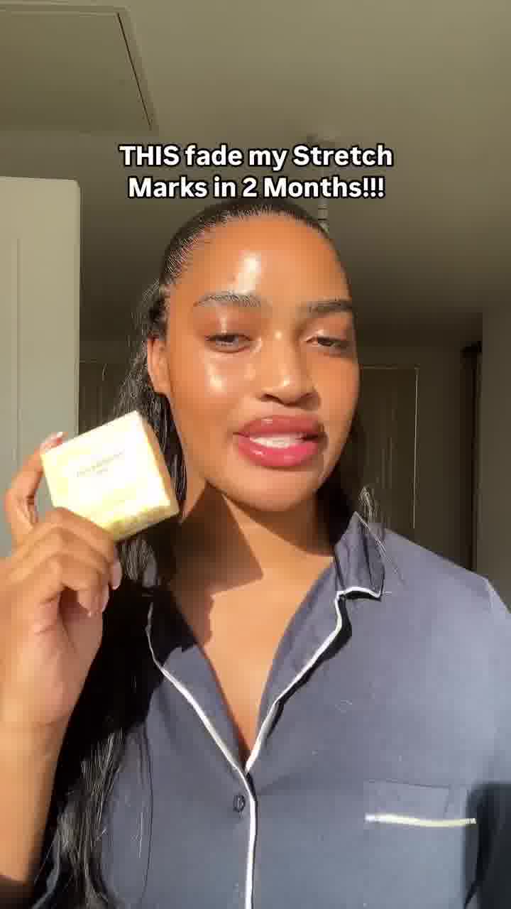 Stretch Marks Fading in 2 Months? Yes, please