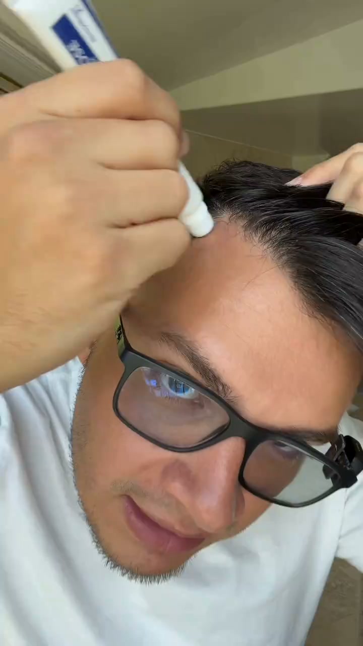 El sérum que reemplaza al minoxidil | 70% de descuento hoy