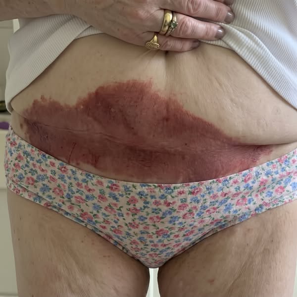 Det är inte ett hygienproblem. En sjuksköterska förklarade varför.