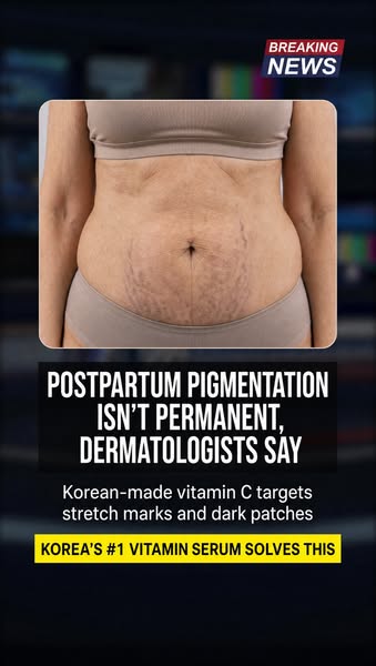 Find Out How Koreans Fade Pigmentation