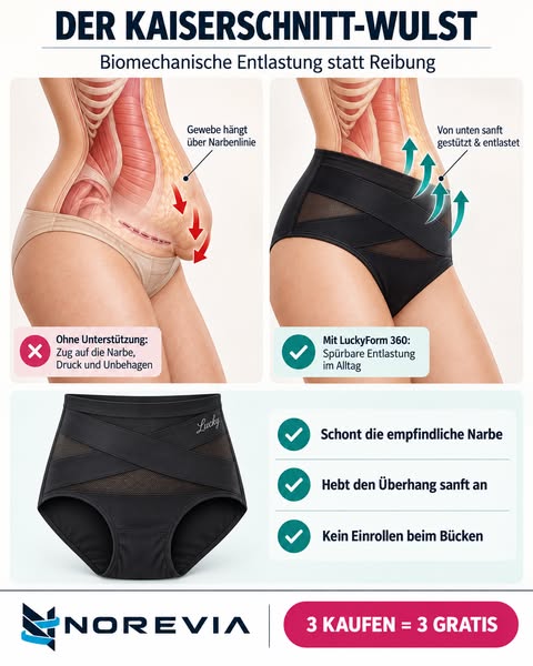 Der Kaiserschnitt-Wulst: Warum Diäten ihn nicht schließen