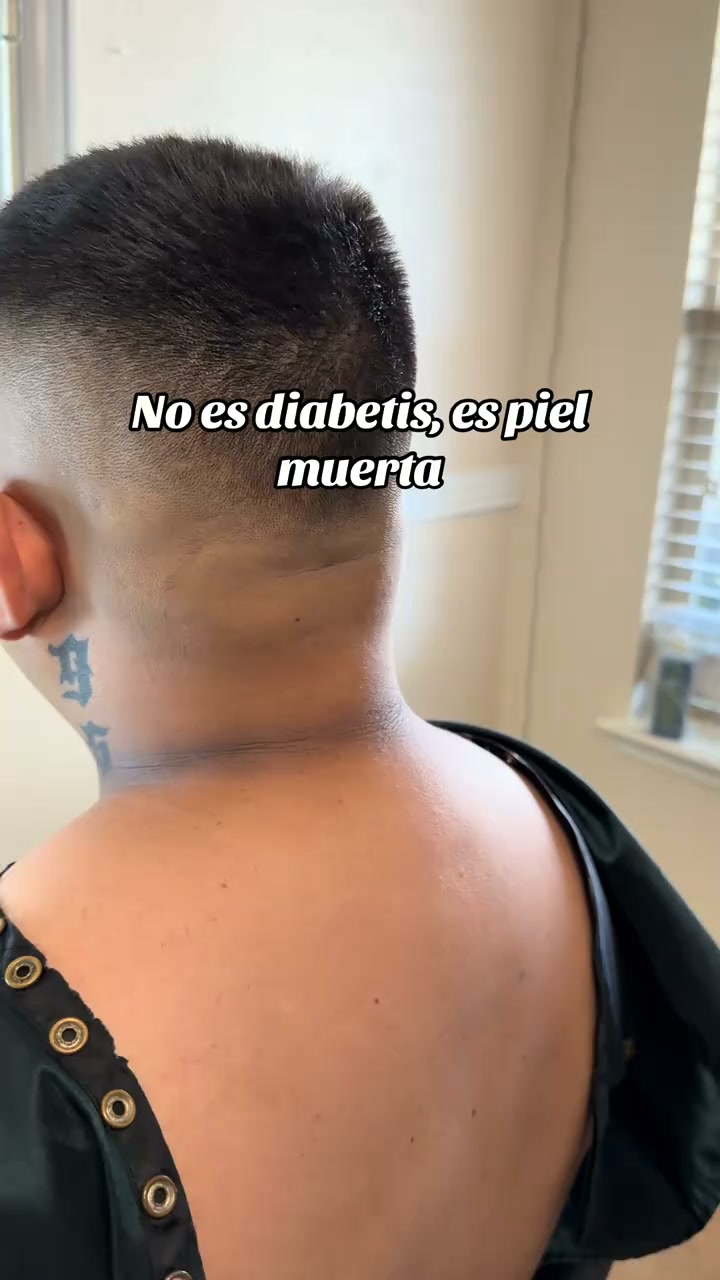 Aclara las manchas oscuras rebeldes en 2 semanas