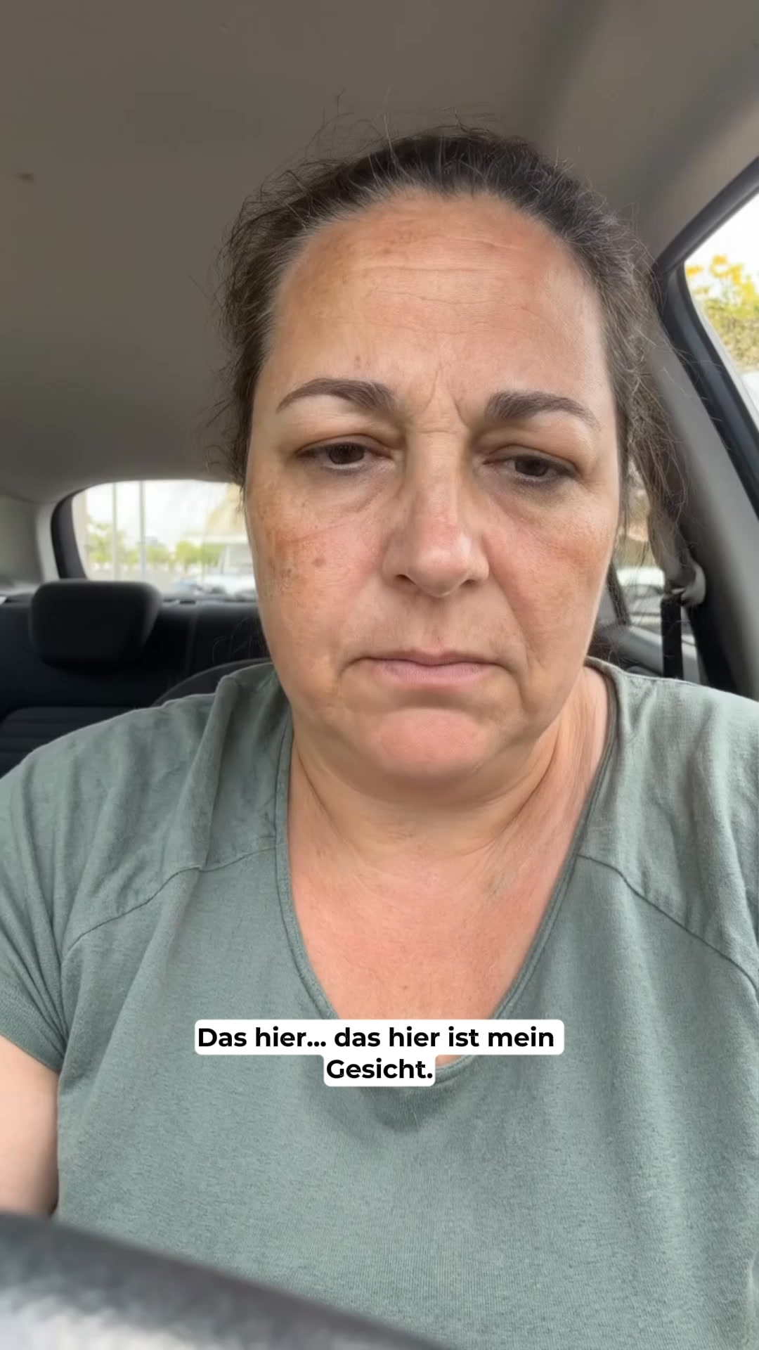 Ihre Haut hat sich verändert. Sie nicht.