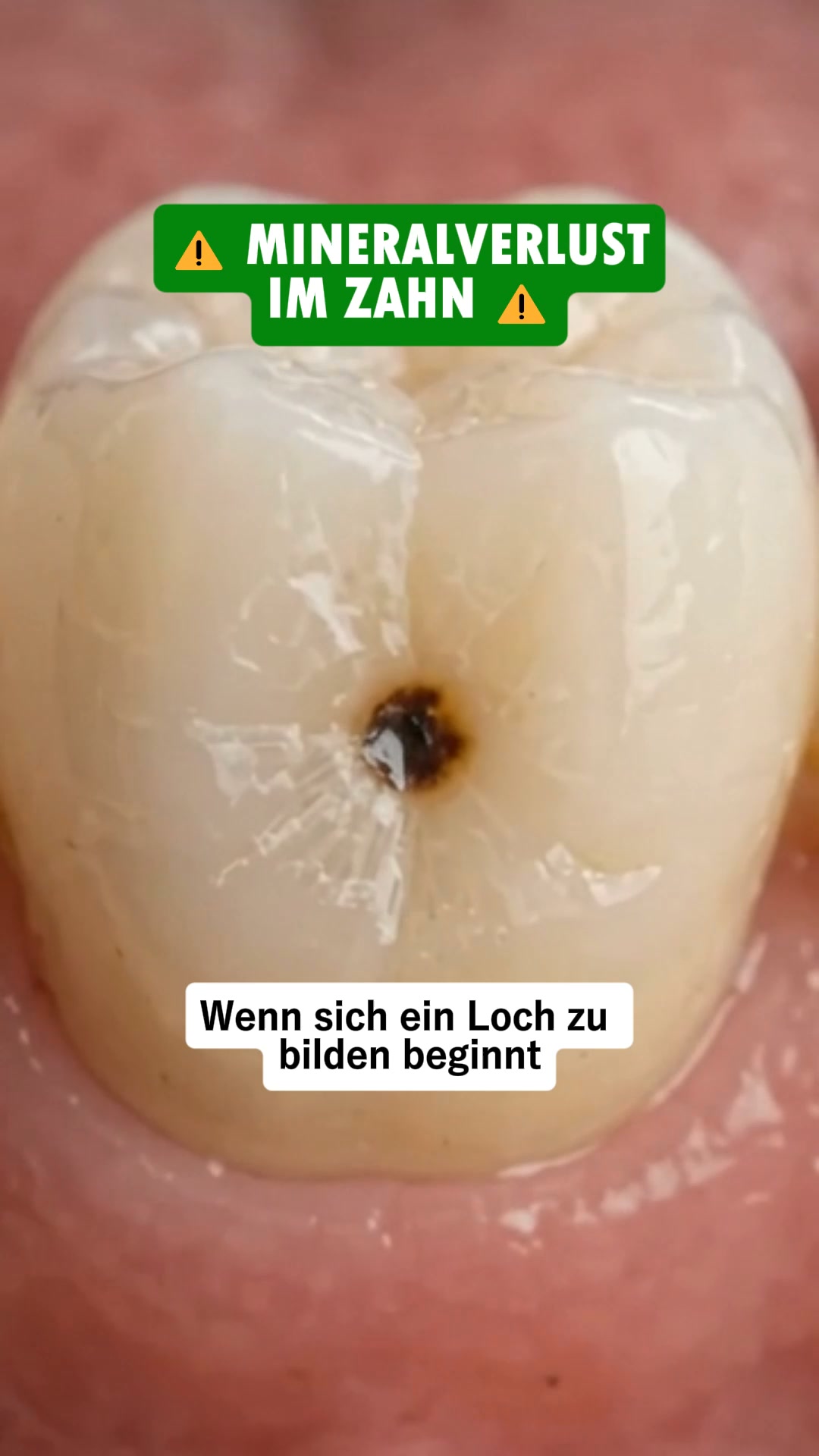 1 Kaugummi, der deine Zähne verändert.