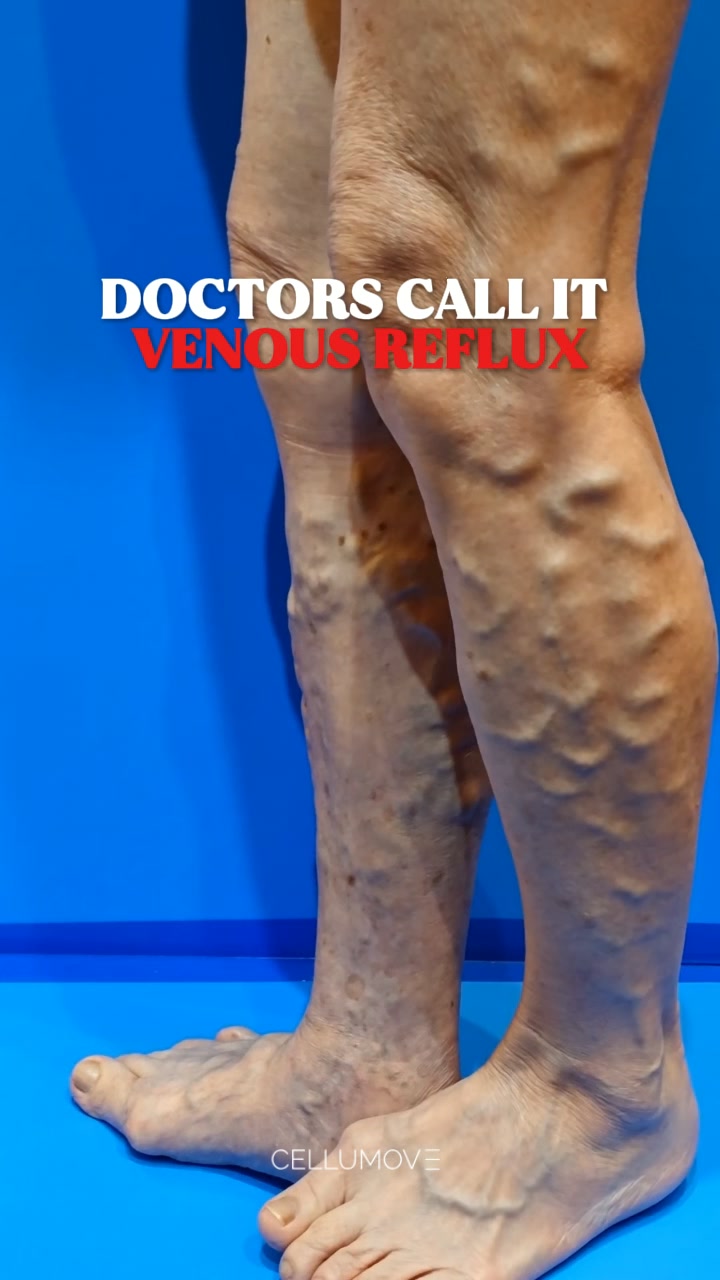 Show Your Legs with Confidence!