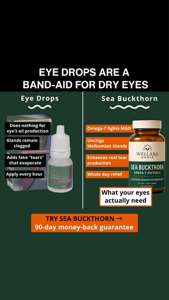 Dry eyes need more than just eye drops