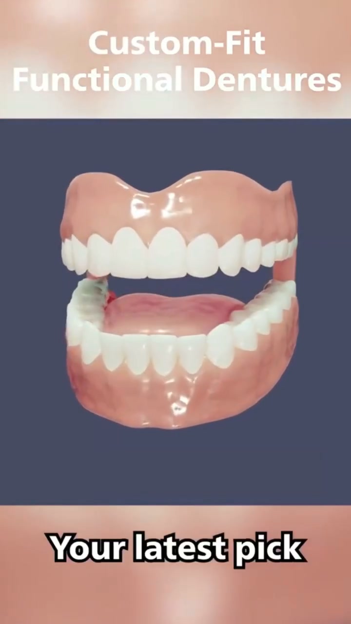 Custom-Fit Dentures for Everyday Comfort