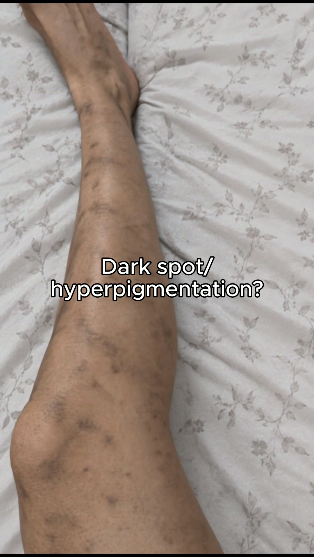 The Cream She Used for 7 Days