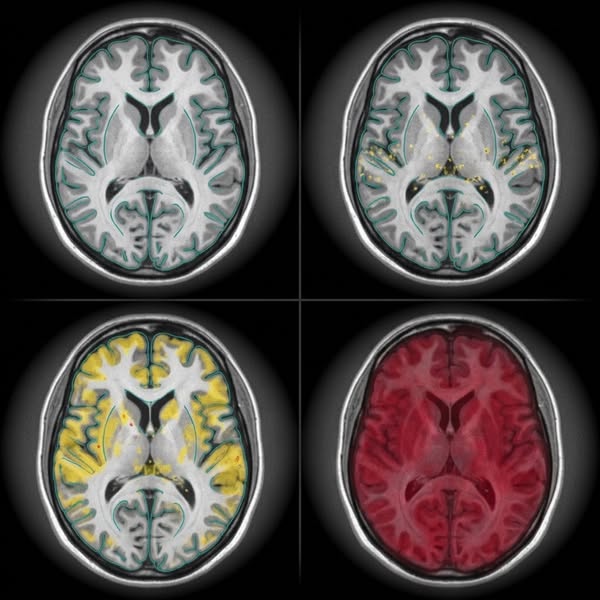 Protect your brain before it's too late