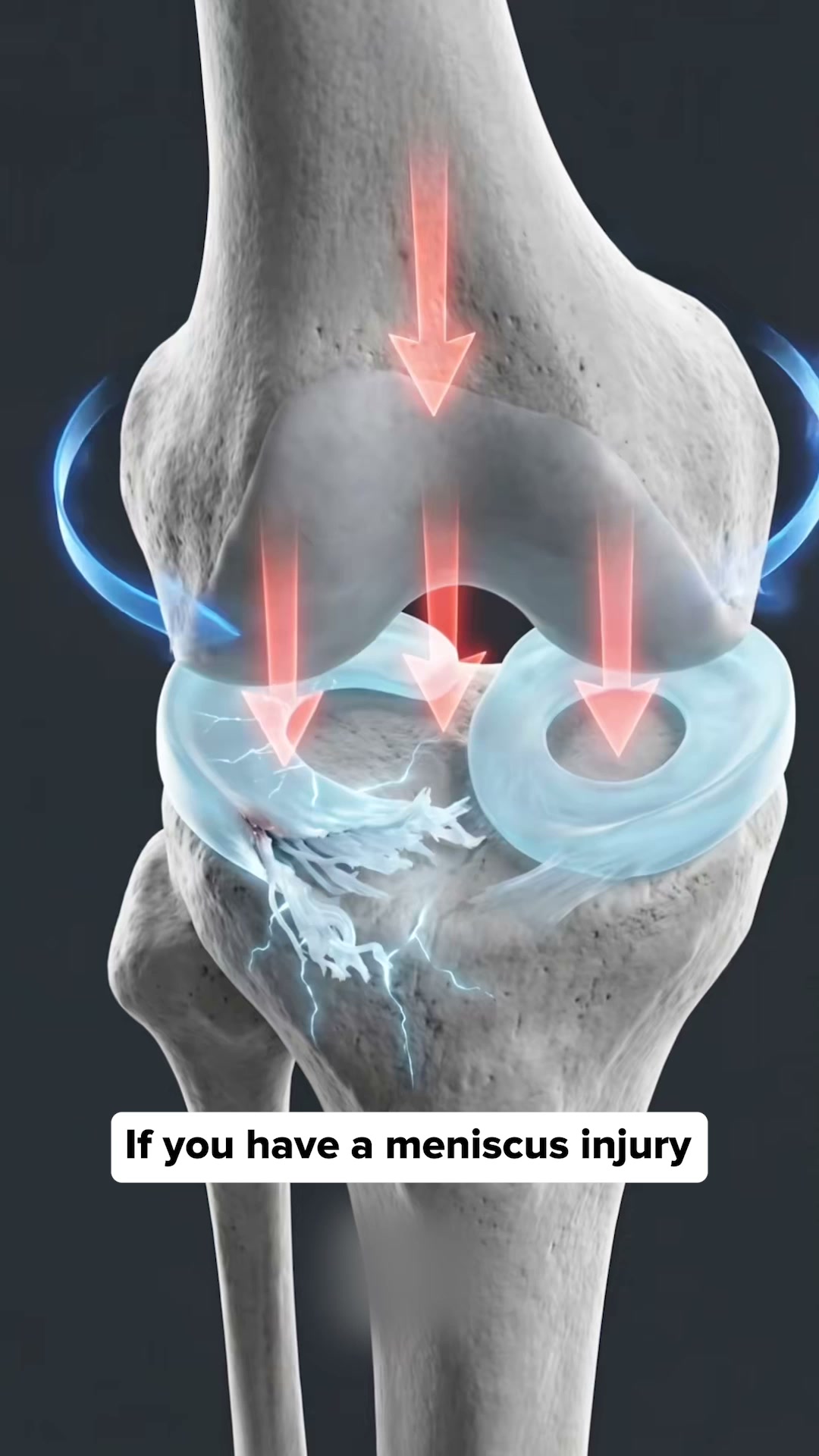 Bye Bye Knee Pain