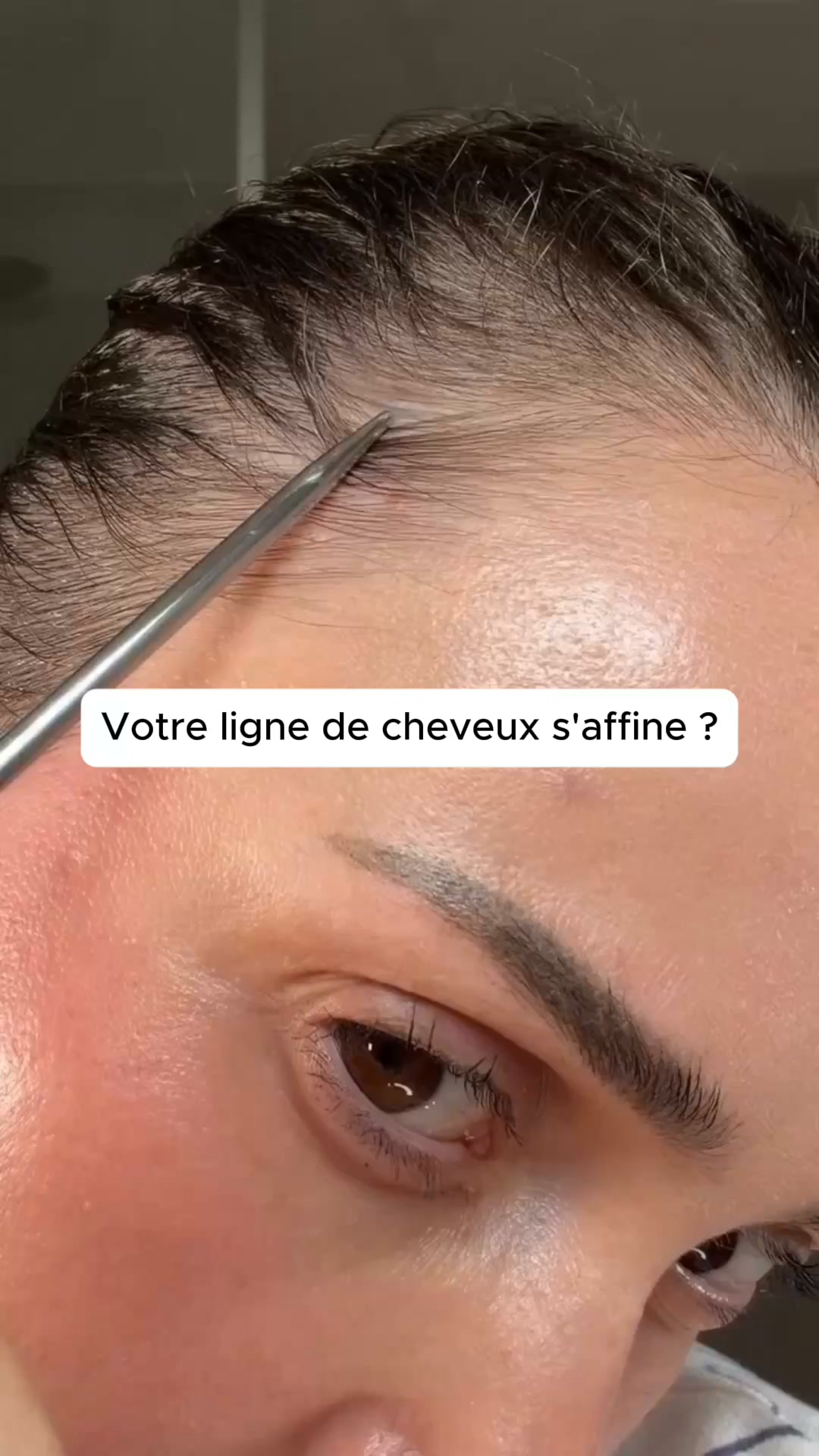 Le boost dont ma peau avait besoin