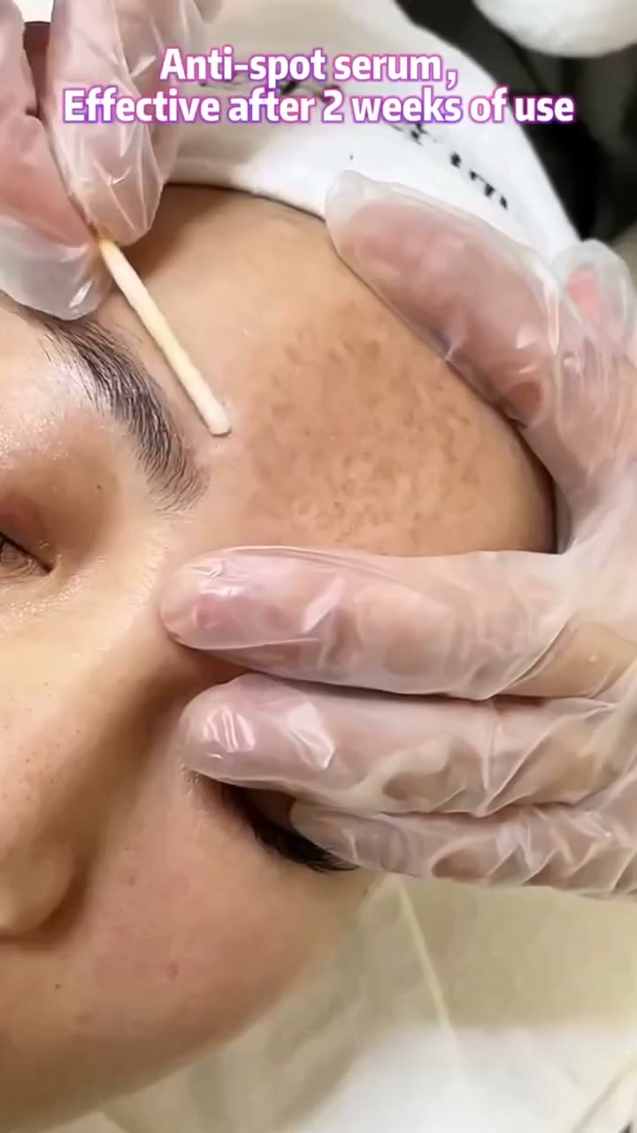 Say Goodbye to Dark Spots