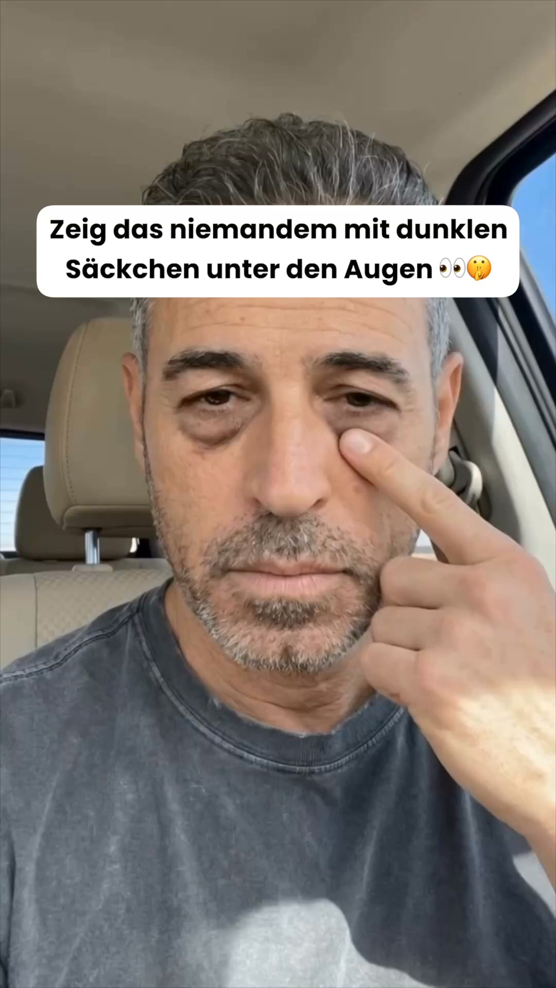 Anúncio de myguy