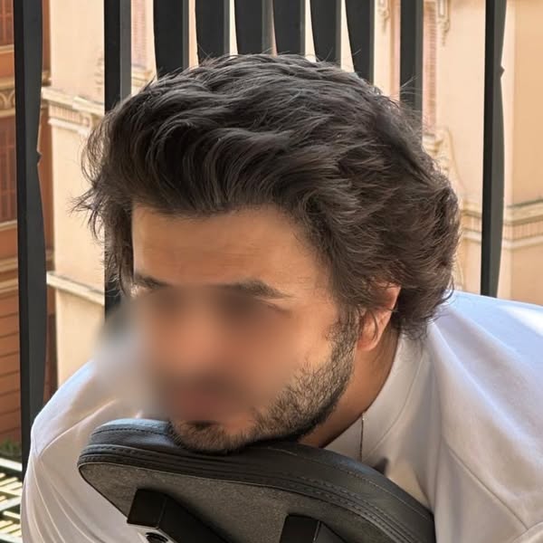 FueGenix | Exclusive Hair Transplant