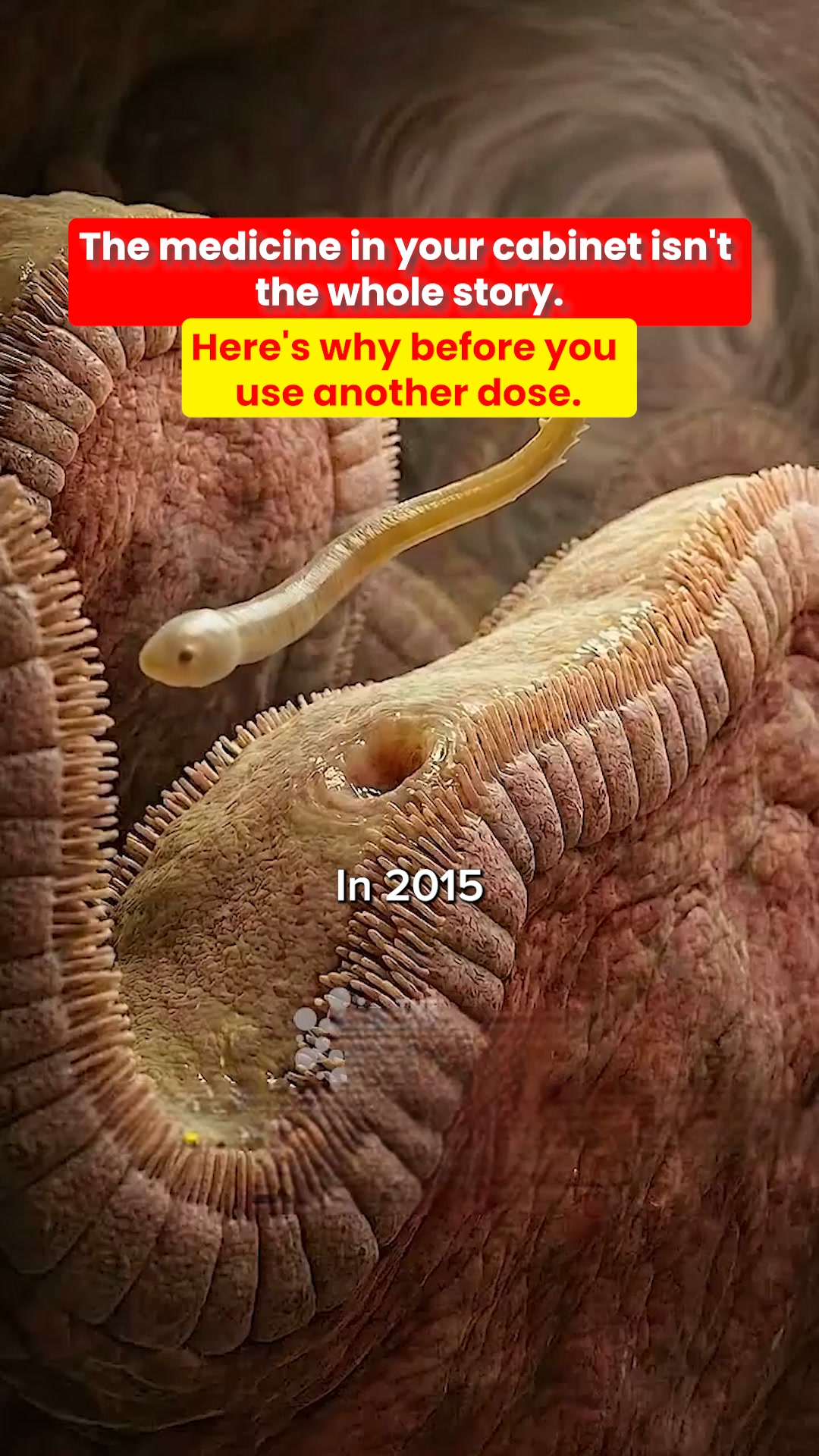 1 in 3 Kids Have Parasites. Most Moms Never Know.