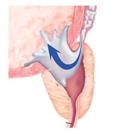 Votre Éjaculation Rétrograde Est L'Avertissement. Votre Cœur Est La Cible.