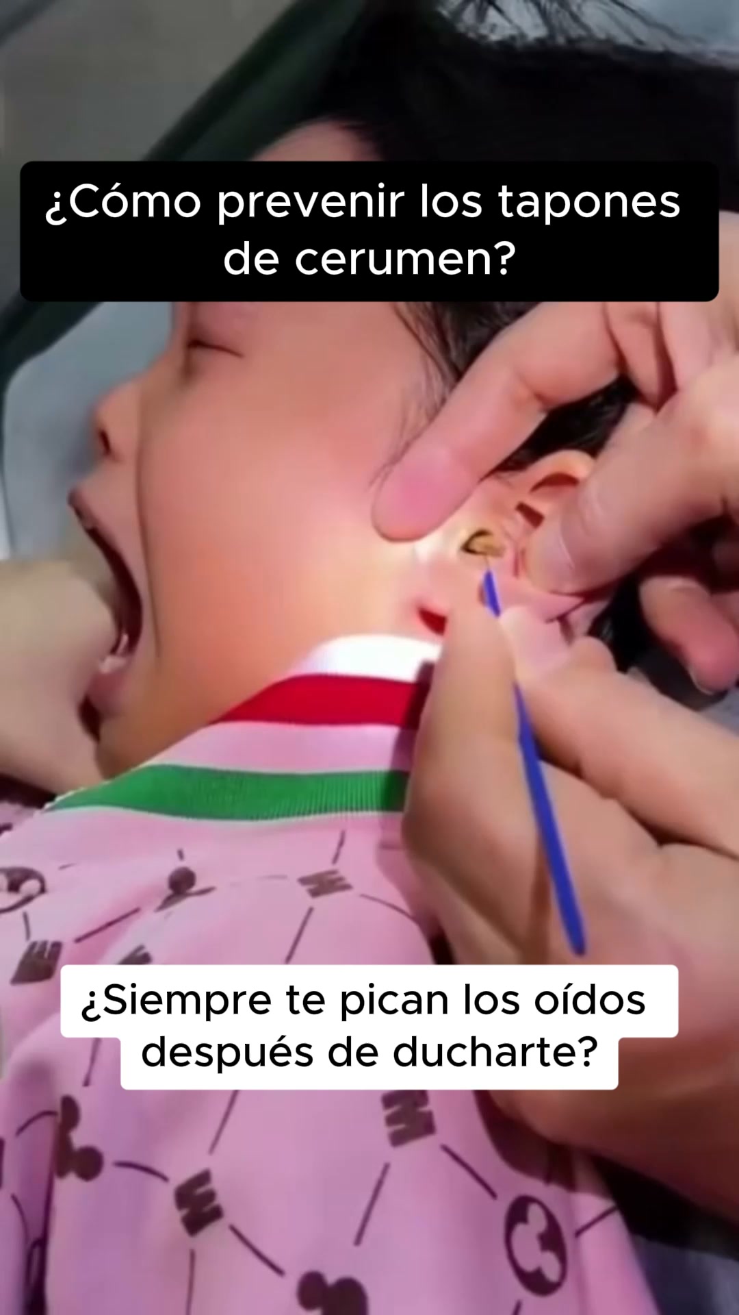 Deja de empujar el cerumen hacia dentro