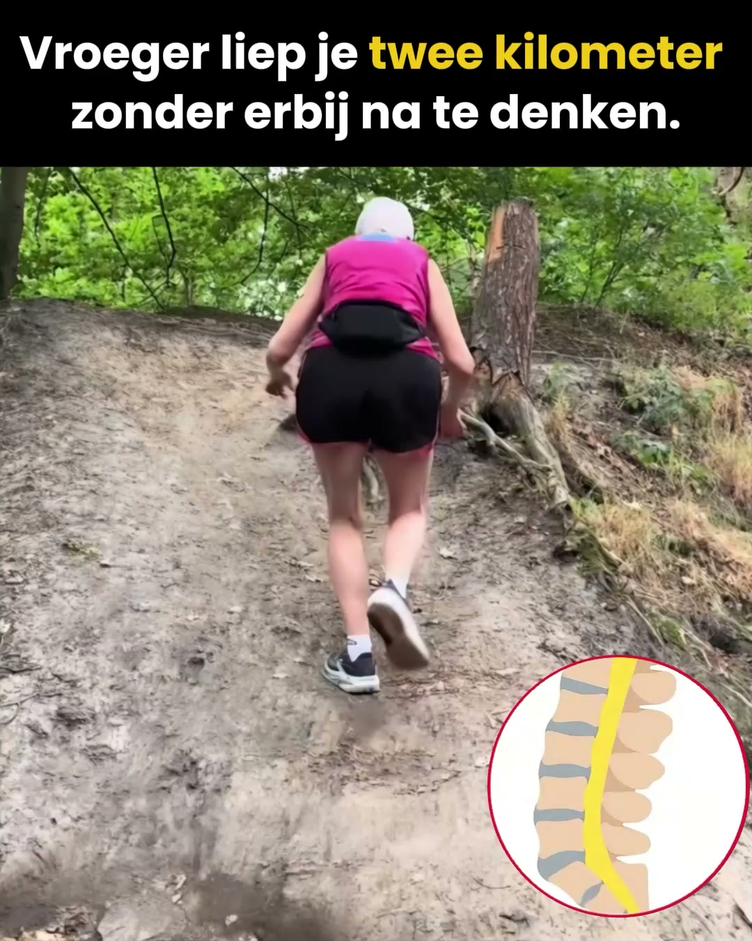 Waarom Spinale Stenose Steeds Erger Wordt (En Hoe Je Het Kunt Stoppen)