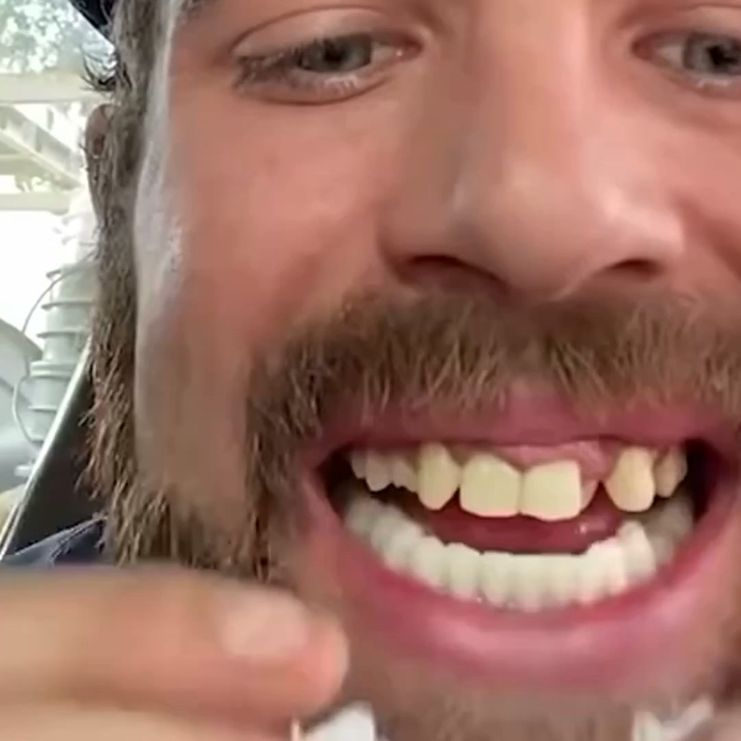 O seu sorriso pode mudar a forma como se sente
