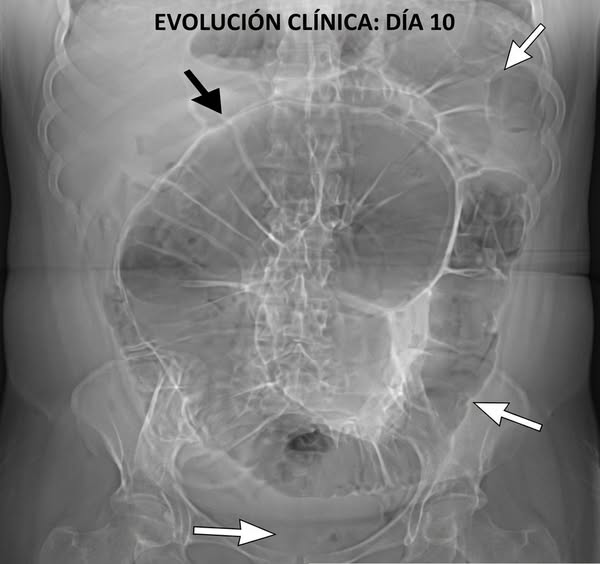 Limpeza Natural Dentro De Tu Cuerpo