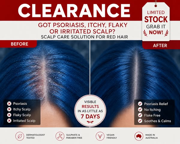 HEAL YOUR SCALP PSORIASIS in 10 Mins a Day