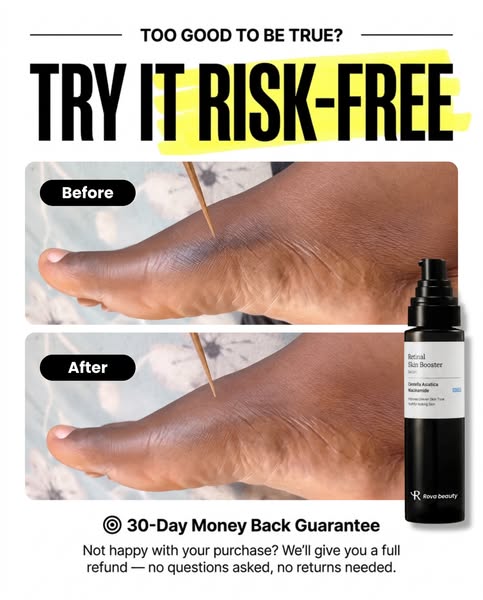 Buy 1, Get 1 FREE