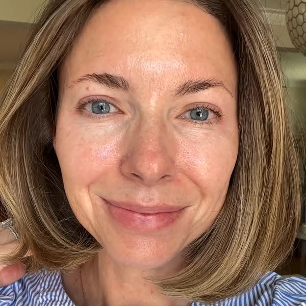 Derm Picks 5 Top Serums