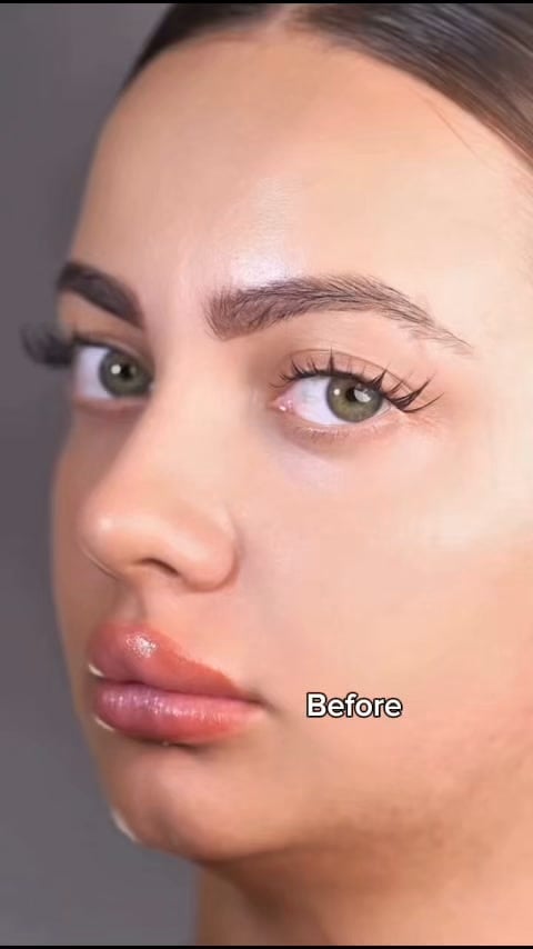 The Beauty Hack For A Snatched Jawline