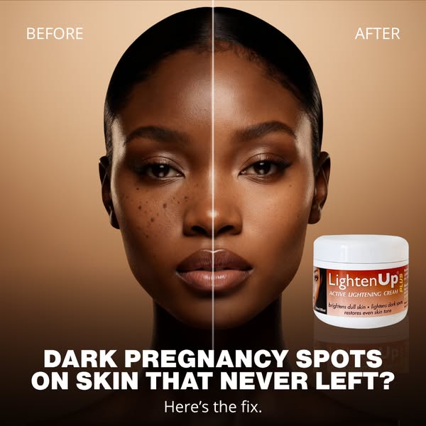 Dark Spots Don't Have To Be Forever