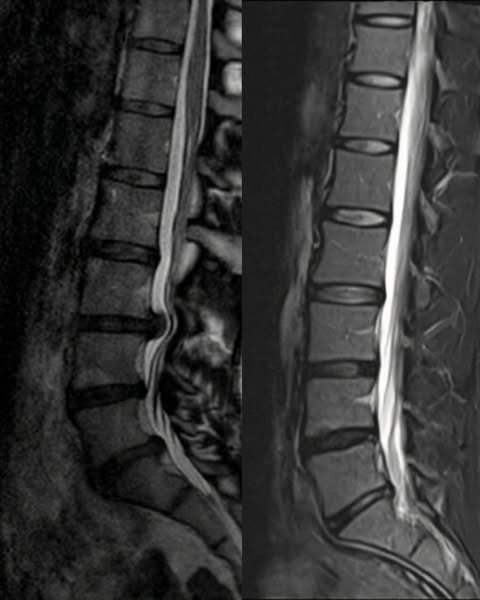 What orthopedic surgeons will NOT tell you