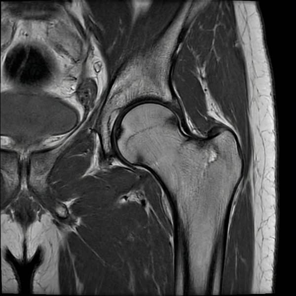 If you’re struggling with joint pain, this is how I...