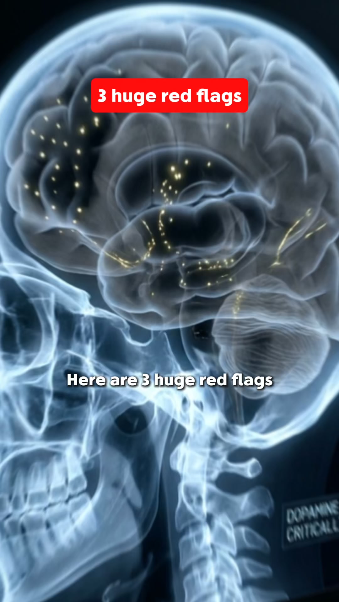 You're Not Lazy. Your Brain Just Needs This