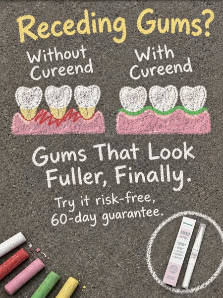 My Gums Kept Pulling Back