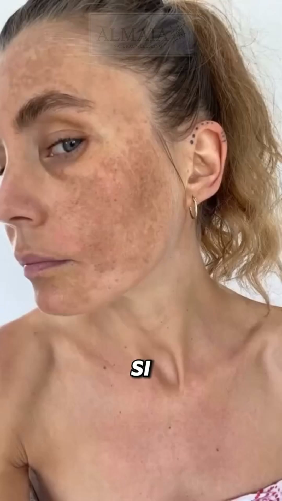 ¿Manchas en la piel? Acláralas con la Crema de Arbutina OFERTA 2 X 1