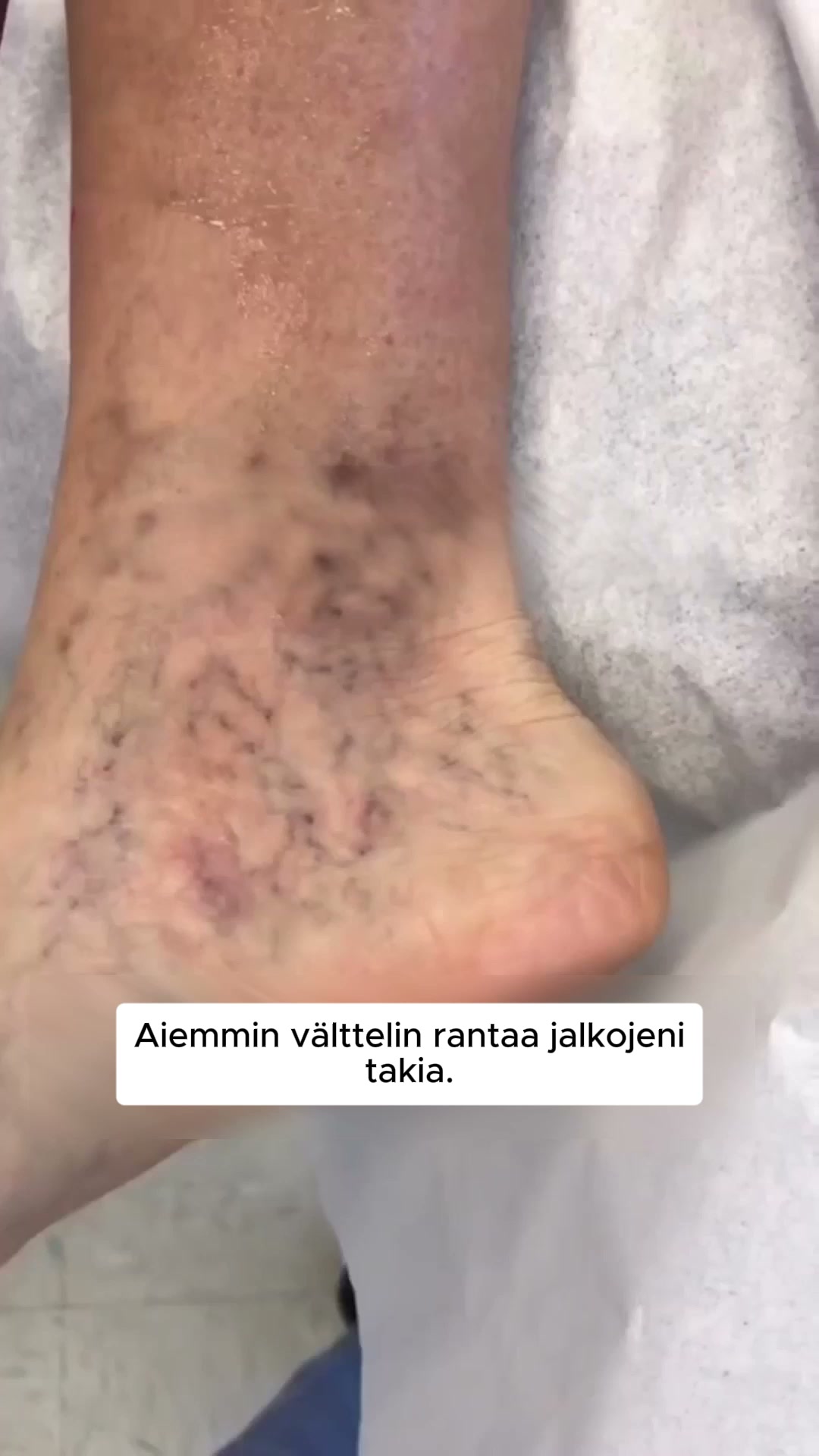 Väsyneet, turvonneet jalat? FlowSocks™ ratkaisee sen vaivattomasti! 4.8/5