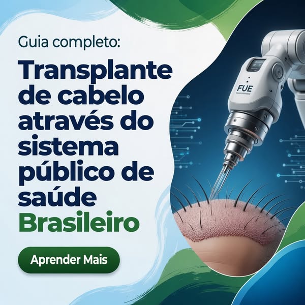 Transplante Capilar: O Que Saber