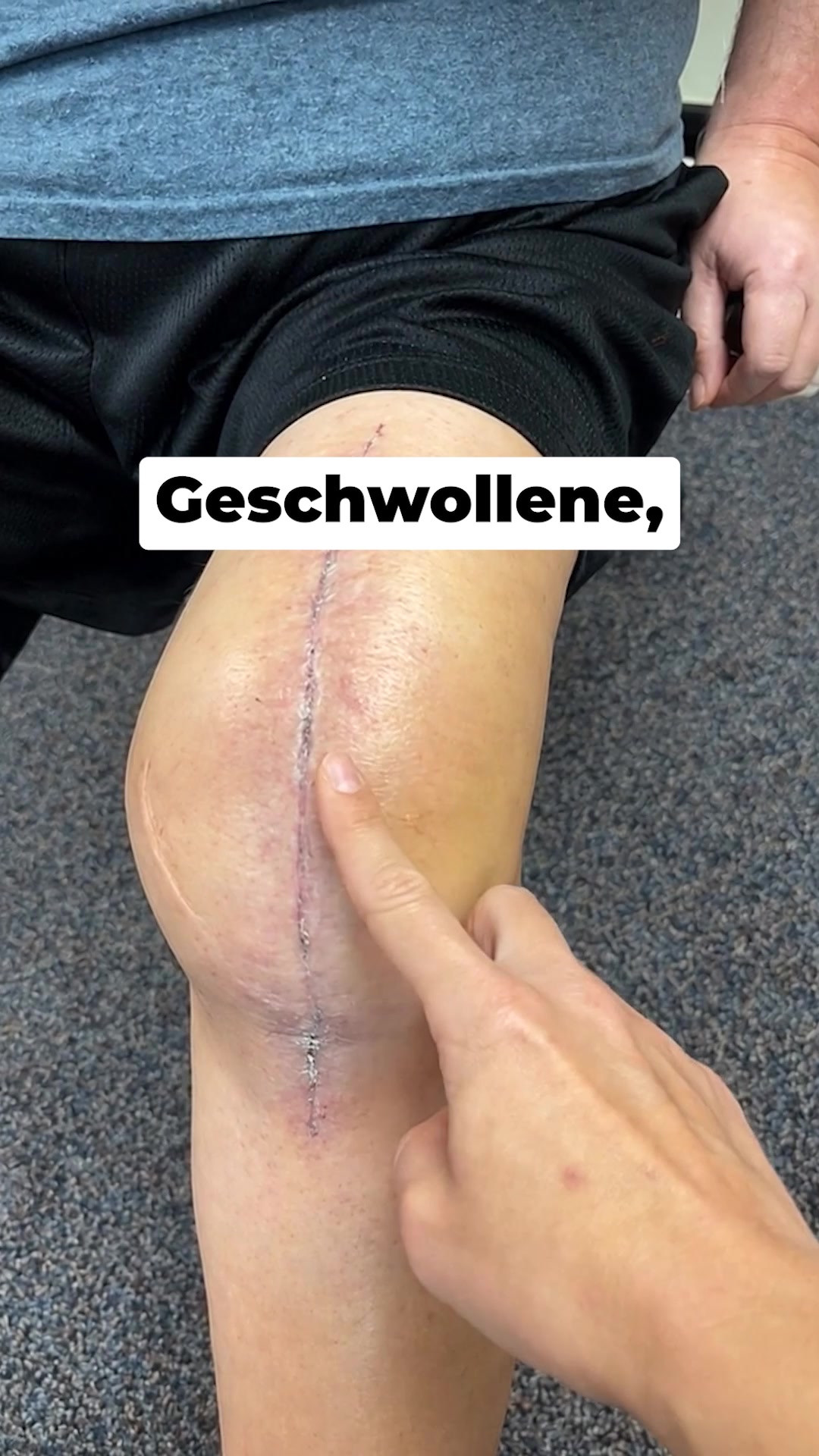 Sagen Sie Knieschmerzen Lebewohl - mit Orthotal